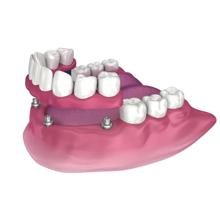 Supported Acrylic Image